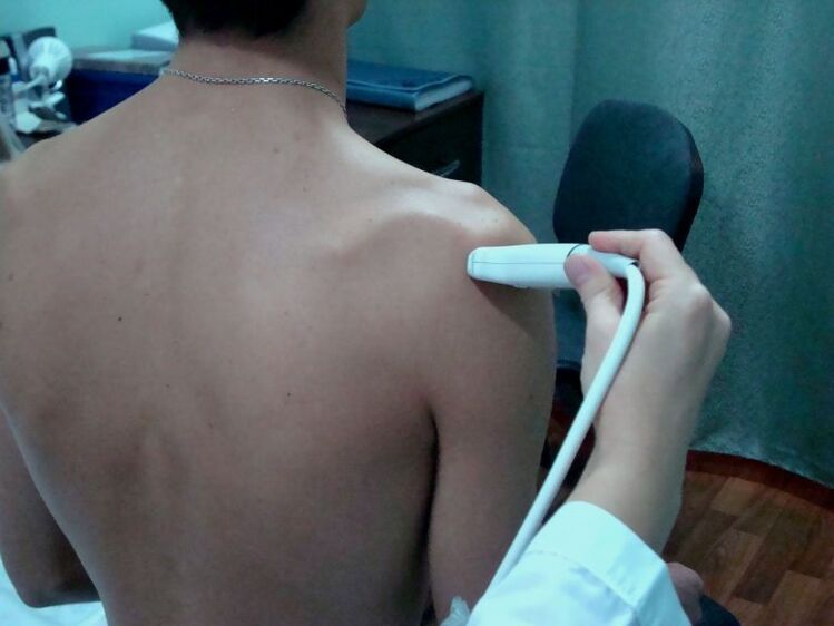 Moderna fizioterapija pomoći će u suočavanju sa simptomima artroze ramena u ranim fazama