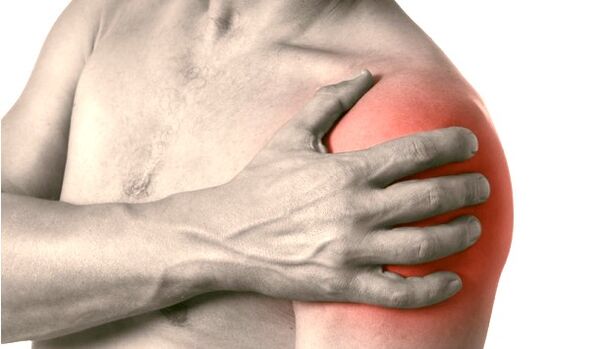 Otečeno, crveno i povećano rame - simptomi artroze ramenog zgloba 2-3 stupnja