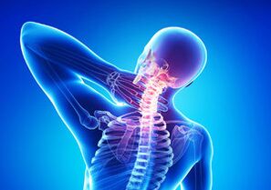 Znakovi cervikalne osteohondroze