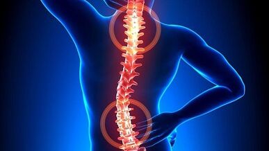 mehanizam razvoja osteohondroze