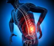 razni uzroci bolova u leđima