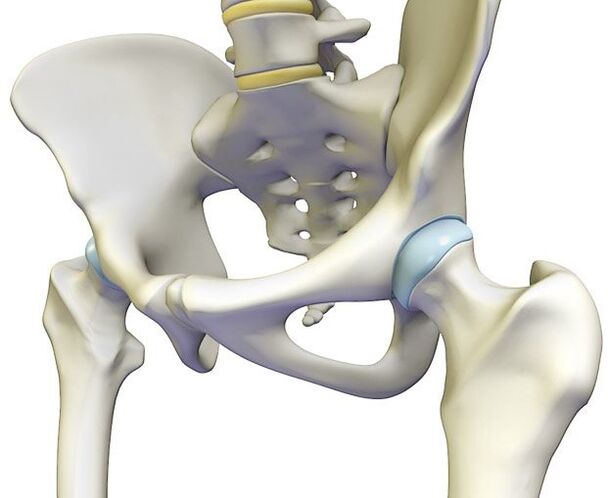 Osteokondroza izaziva oštru bol u zglobu kuka