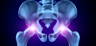 osteoartritis kuka